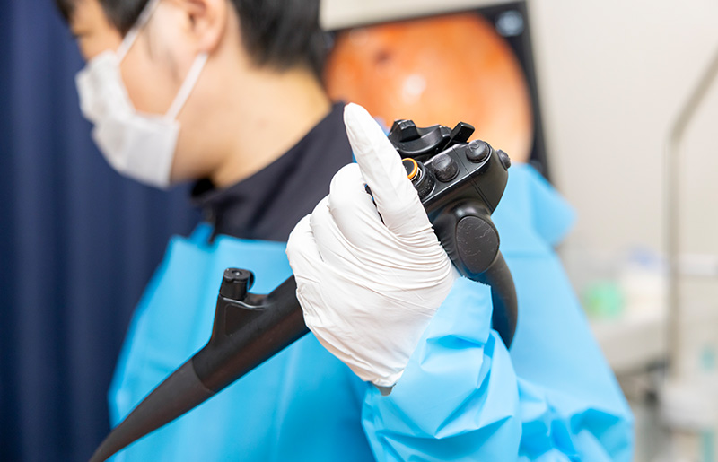 大腸カメラ検査を受ける目安や頻度
