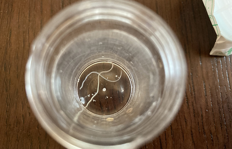 アニサキス症