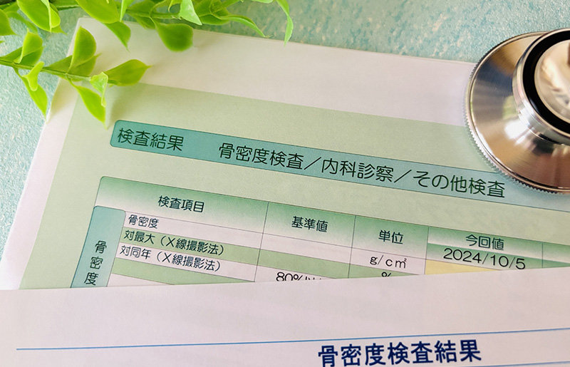 骨密度測定装置（DEXA／MD法）